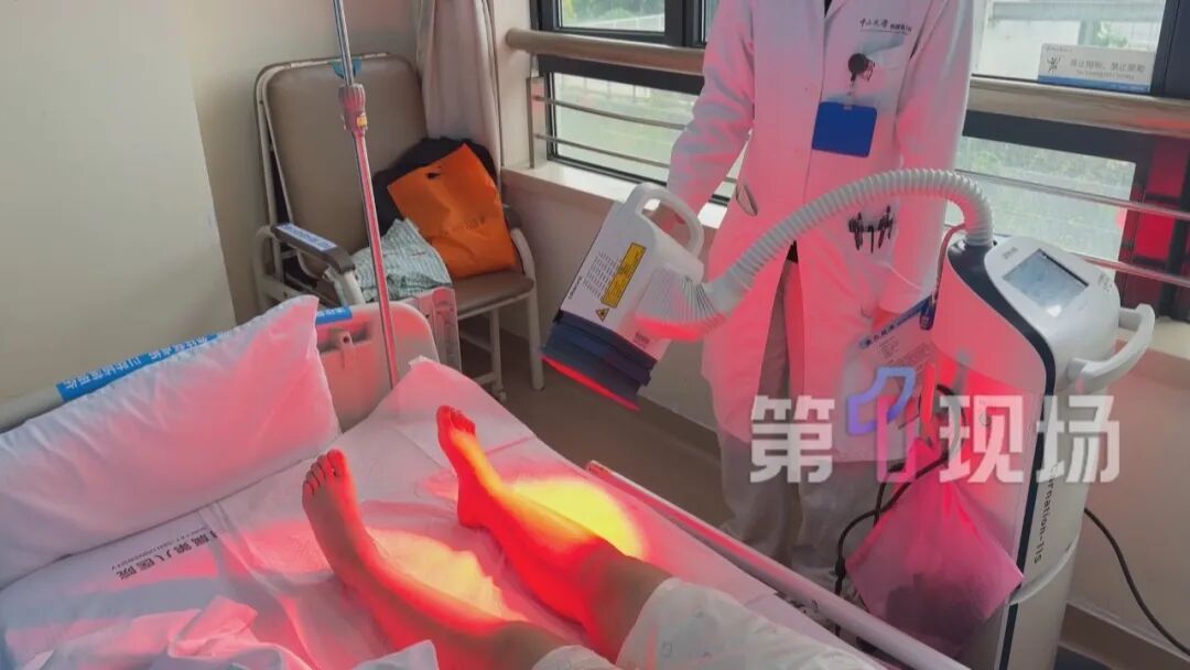 咋这样?为治湿疹忌口三个月,女子腿肿成“猪蹄”! 咋这样?为治湿疹忌口三个月,女子腿肿成“猪蹄”!