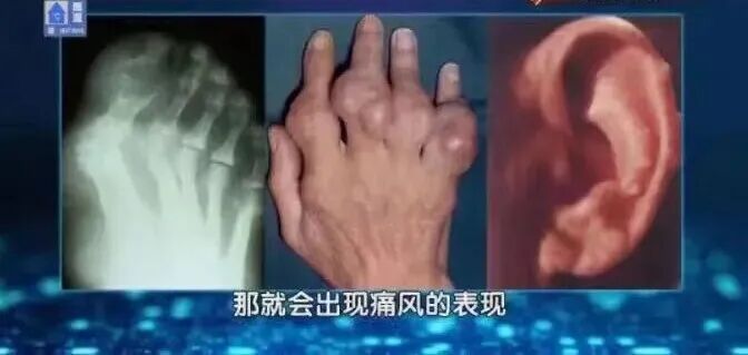 这鱼劝你少吃，有致癌风险，尤其三类人要注意→