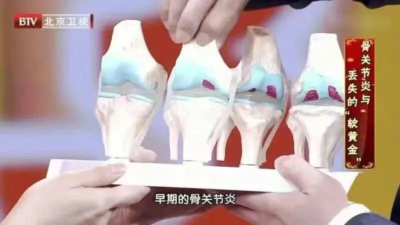 这鱼劝你少吃，有致癌风险，尤其三类人要注意→