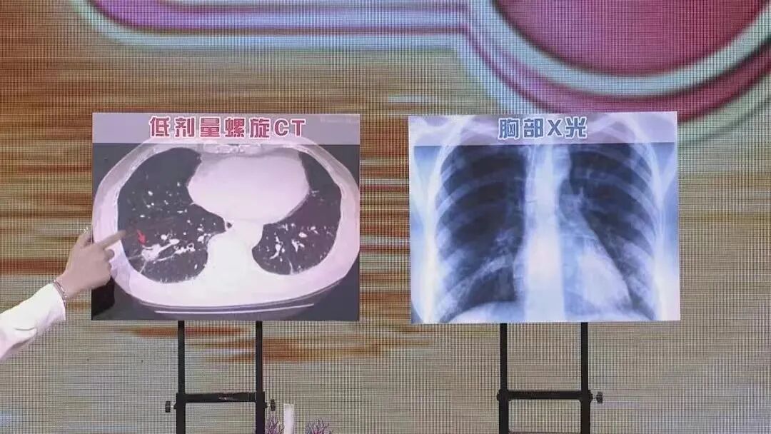 身体给了你6次防止癌变的机会,别一次次错过,人到中年一定要记牢 身体给了你6次防止癌变的机会,别一次次错过,人到中年一定要记牢