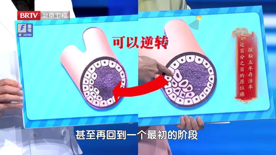 身体给了你这6次防癌机会,别一次次错过! 身体给了你这6次防癌机会,别一次次错过!