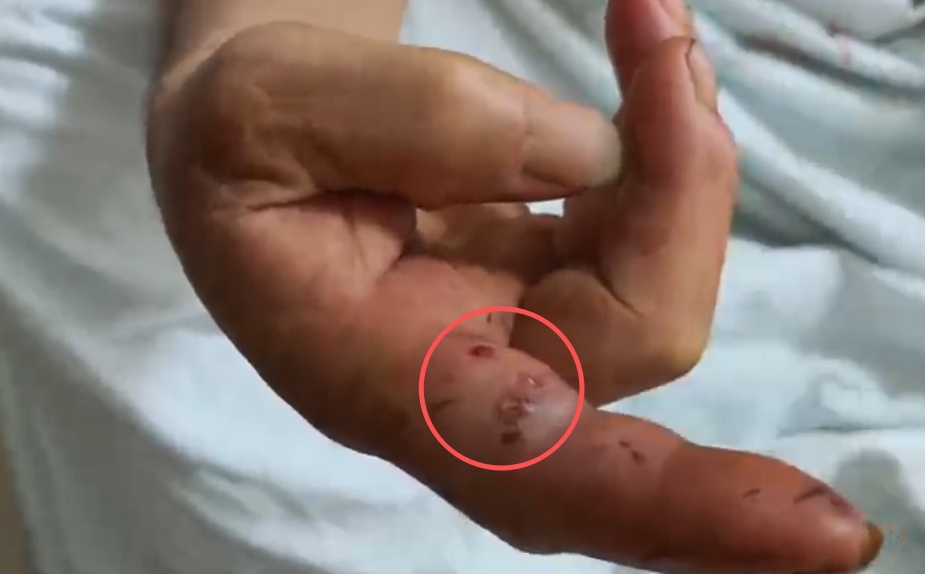 每天捕蛇十七八个小时!广西横州捕蛇者:抓了两千多斤 每天捕蛇十七八个小时!广西横州捕蛇者:抓了两千多斤