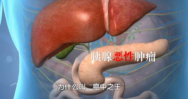 血脂越低,痴呆、癌症风险越高?这个范围内才安全! 血脂越低,痴呆、癌症风险越高?这个范围内才安全!