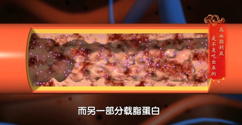 血脂越低,痴呆、癌症风险越高?这个范围内才安全! 血脂越低,痴呆、癌症风险越高?这个范围内才安全!