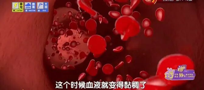 生痰湿还伤脾胃,夏天这类食物劝你少吃,1碗家常面,开胃、祛湿、养心脏,现在吃正好 生痰湿还伤脾胃,夏天这类食物劝你少吃,1碗家常面,开胃、祛湿、养心脏,现在吃正好