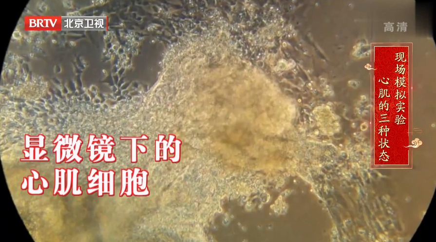 心脏的“防老剂”被发现,就藏在炖肉料包中,能修复心肌、让心跳更有力 心脏的“防老剂”被发现,就藏在炖肉料包中,能修复心肌、让心跳更有力