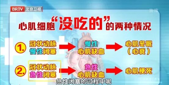 心脏的“防老剂”被发现,就藏在炖肉料包中,能修复心肌、让心跳更有力 心脏的“防老剂”被发现,就藏在炖肉料包中,能修复心肌、让心跳更有力