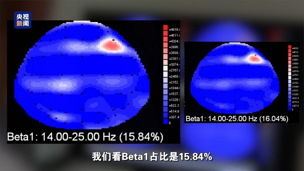 用AI做暑假作业 会改变孩子的大脑吗? 用AI做暑假作业 会改变孩子的大脑吗?