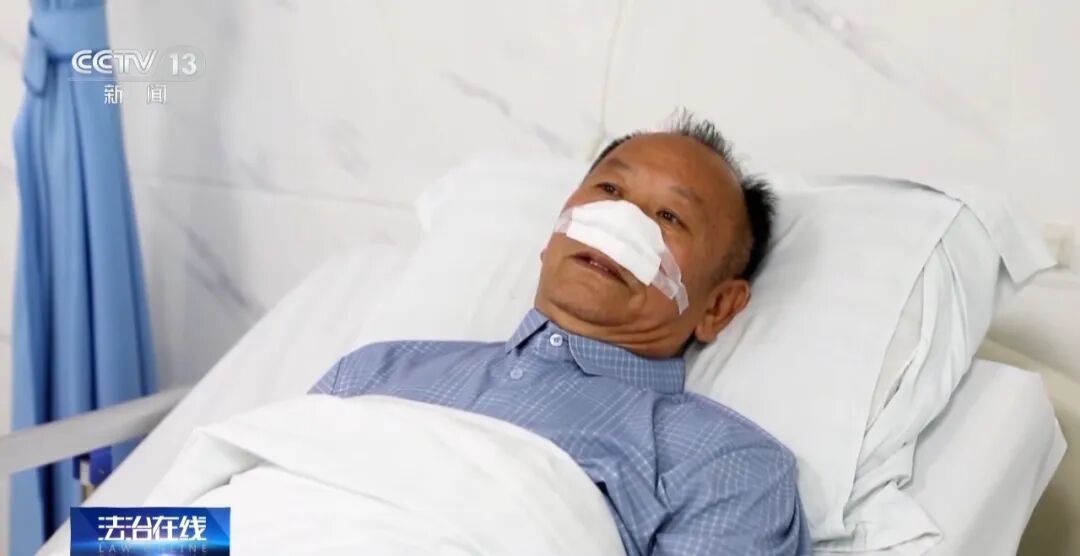 男子当街对女子施暴，69岁大爷制止被咬掉鼻子，但始终没松手