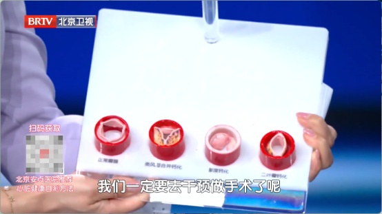 看电视时这个小动作,暴露你的心脏好不好!4种习惯最伤心脏,快停下 看电视时这个小动作,暴露你的心脏好不好!4种习惯最伤心脏,快停下