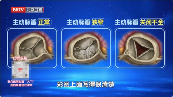 看电视时这个小动作,暴露你的心脏好不好!4种习惯最伤心脏,快停下 看电视时这个小动作,暴露你的心脏好不好!4种习惯最伤心脏,快停下