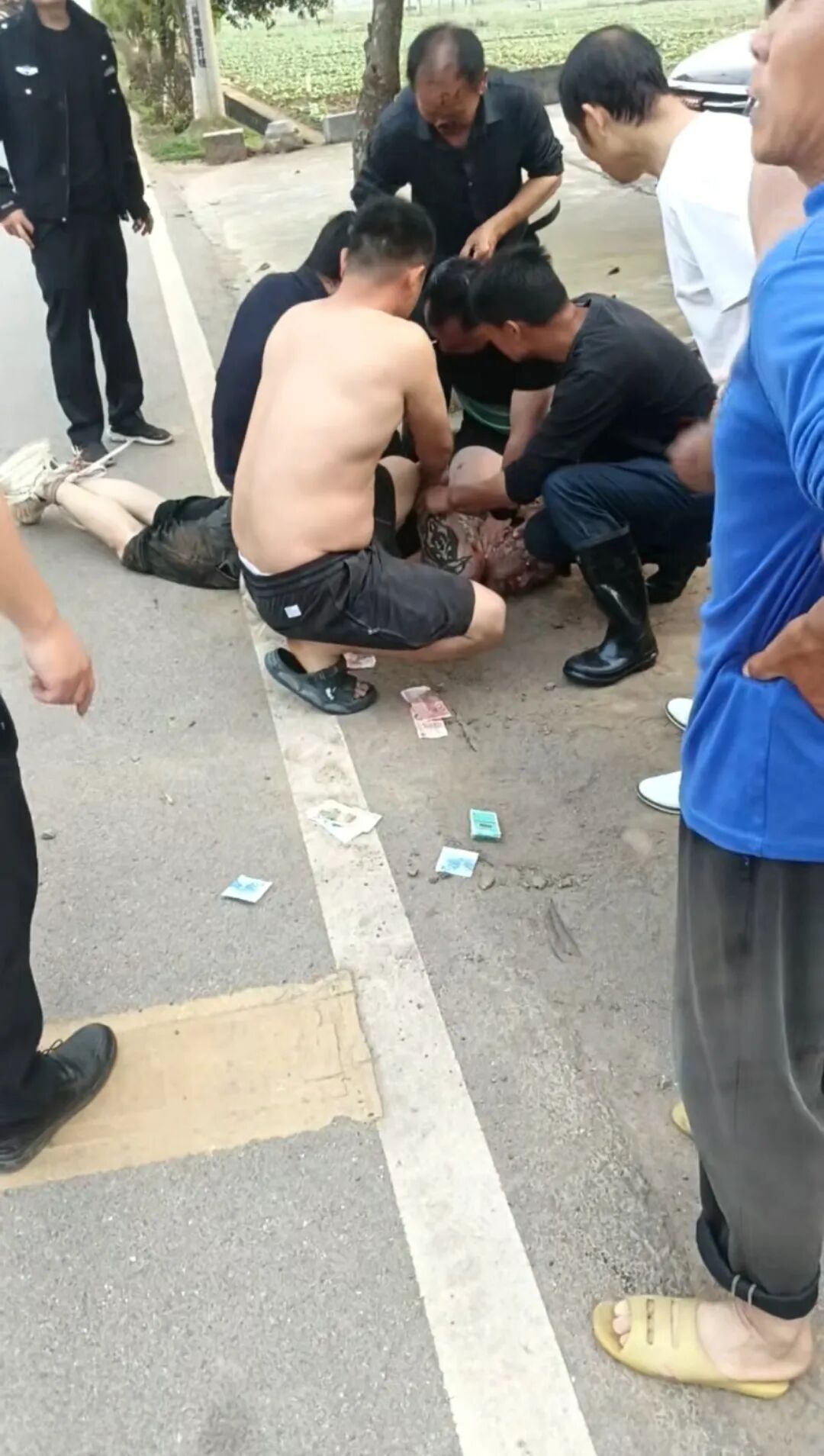 男子当街对女子施暴，69岁大爷制止被咬掉鼻子，但始终没松手