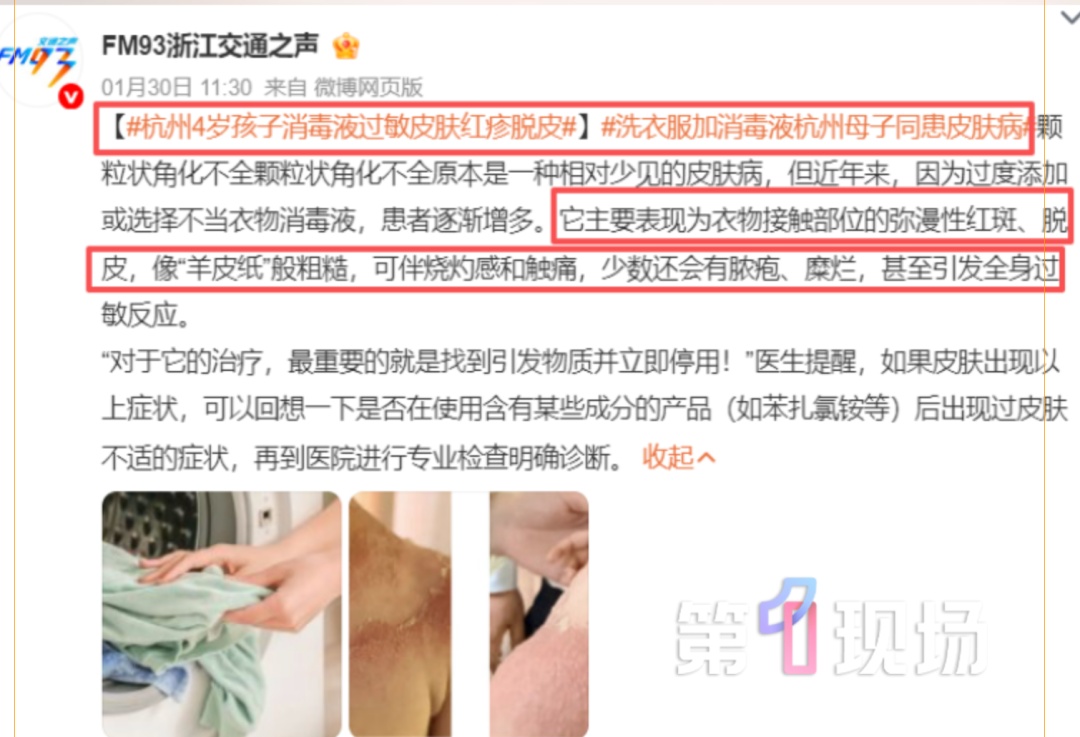 多个孩子接连“中招”,又痒又疼还脱皮! 多个孩子接连“中招”,又痒又疼还脱皮!