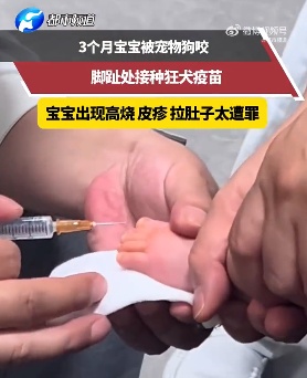 又有4人被咬!近期高发,大人小孩千万当心 又有4人被咬!近期高发,大人小孩千万当心