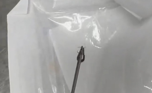 女子耳朵瘙痒刺痛 ,医生掏出一条3厘米活蜈蚣...... 女子耳朵瘙痒刺痛 ,医生掏出一条3厘米活蜈蚣......