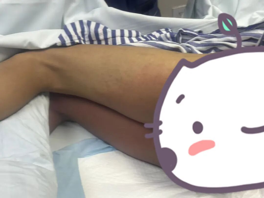 敌敌畏溅到裤子上,数小时后17岁男孩被下达病危通知书!医生紧急提醒 敌敌畏溅到裤子上,数小时后17岁男孩被下达病危通知书!医生紧急提醒