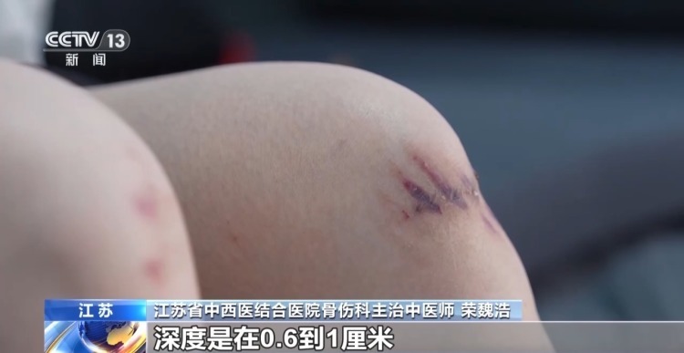 两位老人乘电梯时摔倒 短短十多秒他们无缝接力施救 两位老人乘电梯时摔倒 短短十多秒他们无缝接力施救