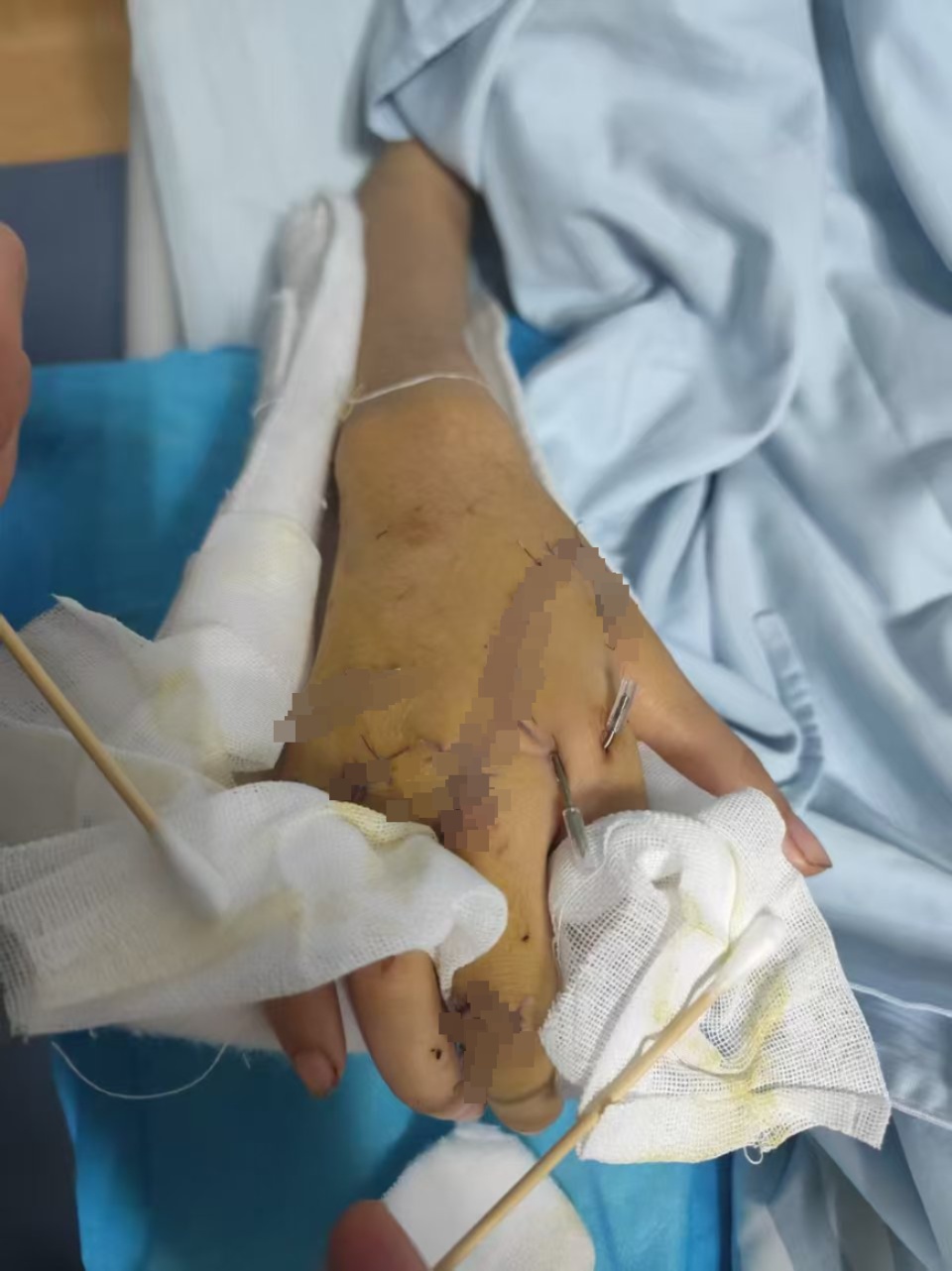 21岁双胞胎姐妹遭妹妹前男友入室伤害,致1死1伤,凶手一审被判死刑 21岁双胞胎姐妹遭妹妹前男友入室伤害,致1死1伤,凶手一审被判死刑