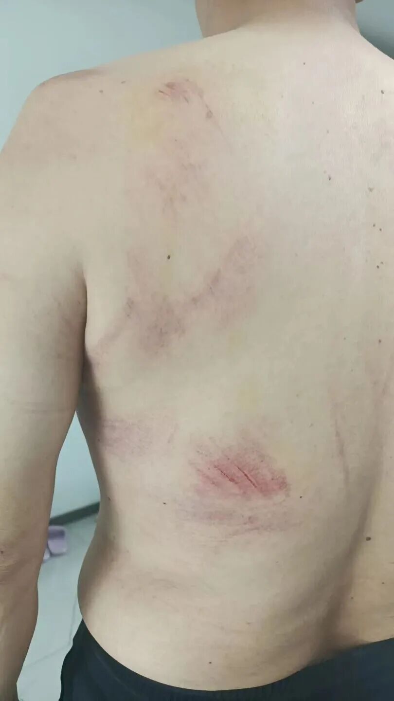 乌鲁木齐5岁男童坠井,62岁大叔不顾危险下井捞娃!当事人:能挽救一条生命,倍感光荣 乌鲁木齐5岁男童坠井,62岁大叔不顾危险下井捞娃!当事人:能挽救一条生命,倍感光荣