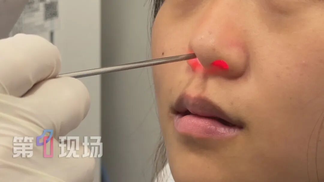 9岁女童一个动作面部流脓,差点毁容!很多人不自觉会做,紧急提醒:严重可致命 9岁女童一个动作面部流脓,差点毁容!很多人不自觉会做,紧急提醒:严重可致命