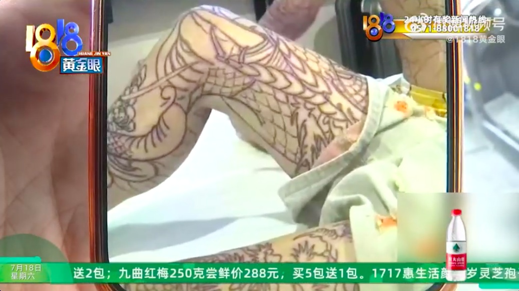 14岁少年纹身纹成大花腿,家长质疑纹身店,要求赔偿20万元 14岁少年纹身纹成大花腿,家长质疑纹身店,要求赔偿20万元
