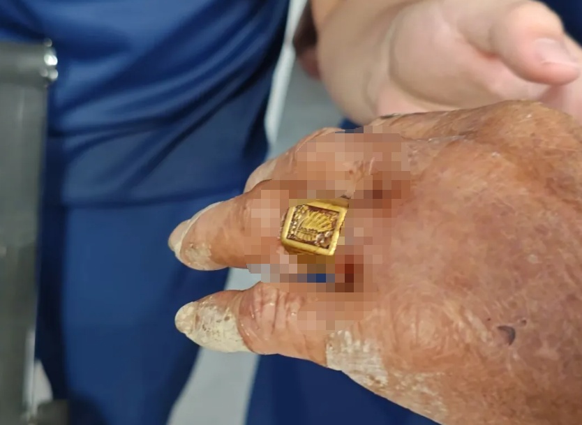 老人被毒蛇咬伤紧急就医,手上的它却成了“拦路虎”…… 老人被毒蛇咬伤紧急就医,手上的它却成了“拦路虎”……