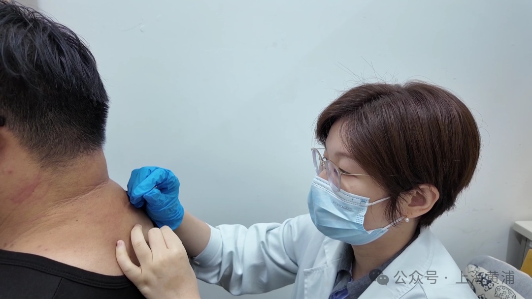 意外了!西瓜蒸熟能治病?上海这家医院的独门秘方又火了→ 意外了!西瓜蒸熟能治病?上海这家医院的独门秘方又火了→
