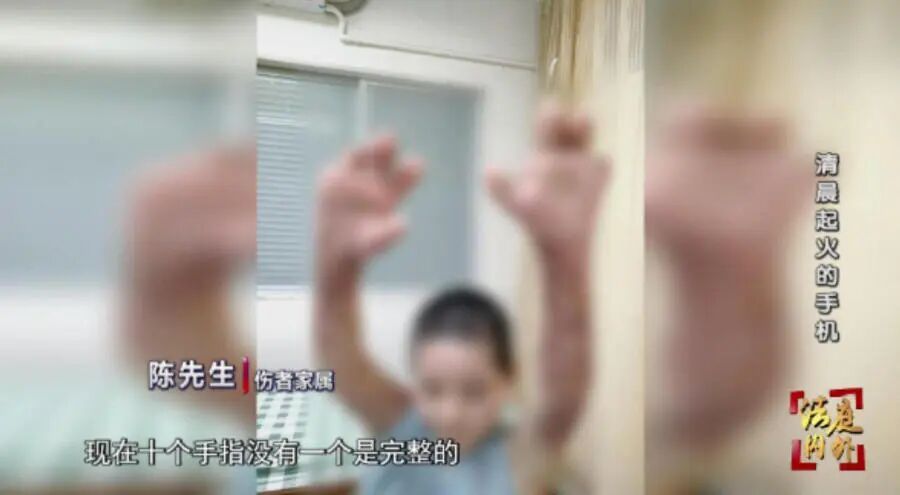 卧床边充电边刷手机,全身被严重烧伤!法院:自身承担40%责任,卖家被判赔63万元 卧床边充电边刷手机,全身被严重烧伤!法院:自身承担40%责任,卖家被判赔63万元