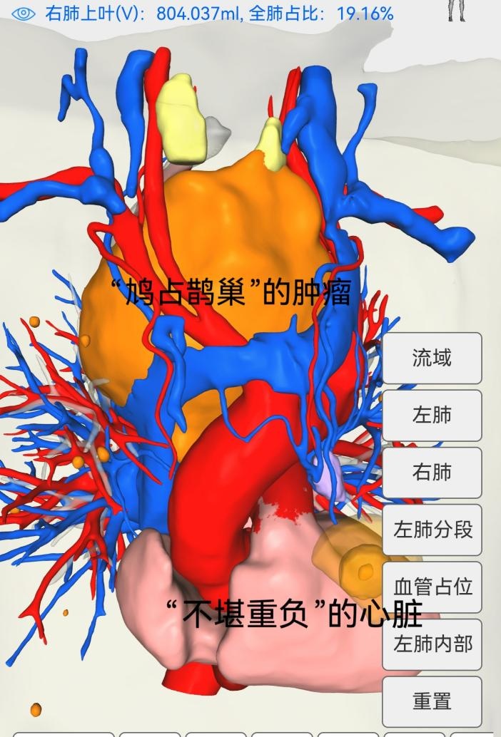 男子呼吸像吹哨,确诊了!这种病很容易被忽视 男子呼吸像吹哨,确诊了!这种病很容易被忽视