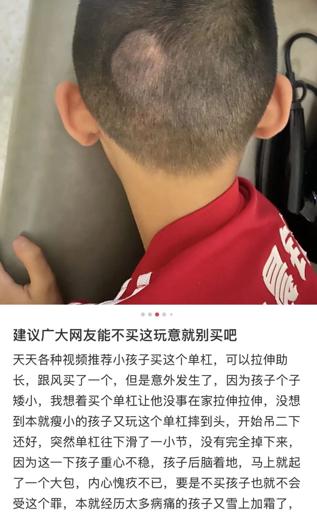 短短几秒，从家摔进ICU！头部着地，瞳孔不等大，紧急开颅……在家千万别用这个锻炼！