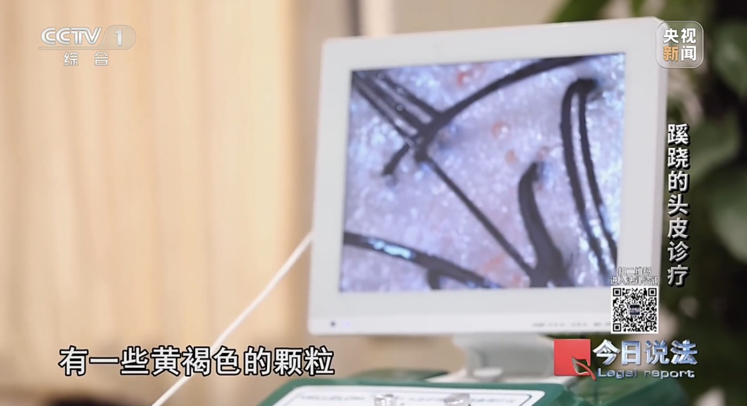 洗个头花2万元！警方破获特大美发诈骗案