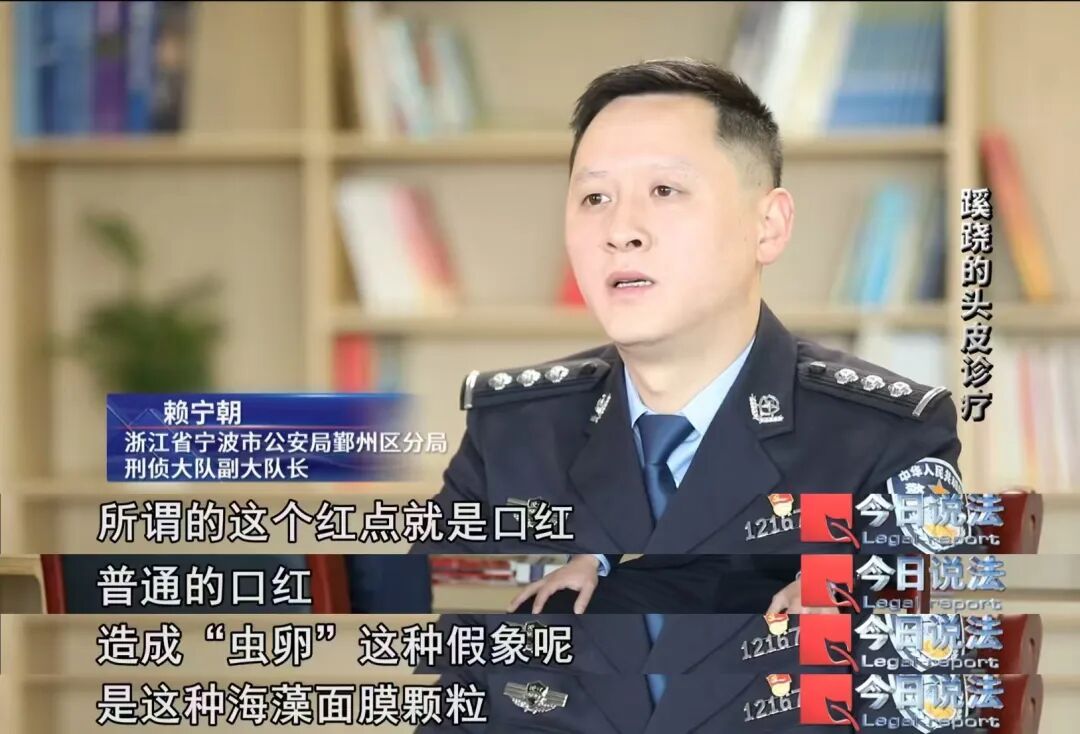 洗个头花2万!理发检出“虫卵”和红疹,吓蒙了…… 洗个头花2万!理发检出“虫卵”和红疹,吓蒙了……