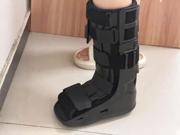 夏季崴脚频发、严重骨折！“凶手”多是这款潮鞋，医生提醒