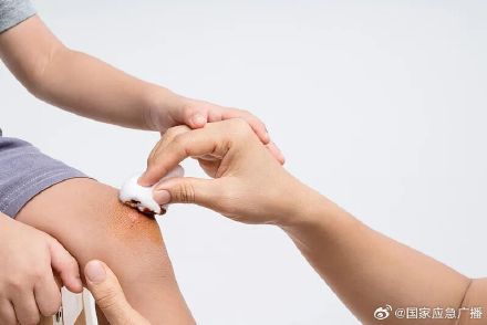 雨天摔破皮别用纸巾擦伤口 雨天摔破皮别用纸巾擦伤口