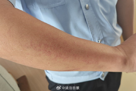 女子阻碍执法 泼开水烫伤执法人员被拘 女子阻碍执法 泼开水烫伤执法人员被拘