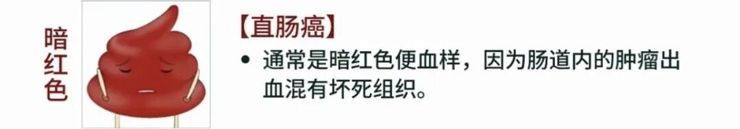 东野圭吾因结肠癌去世，超70%患者确诊即中晚期！这些早期信号千万别不当回事→
