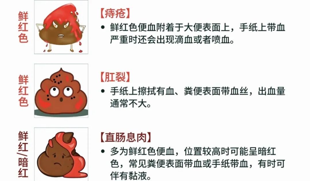 东野圭吾因结肠癌去世，超70%患者确诊即中晚期！这些早期信号千万别不当回事→