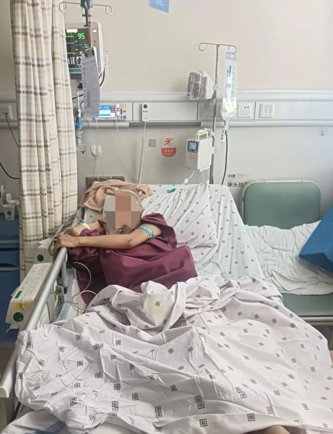 20岁女孩从18楼坠落，经医院抢救奇迹生还，家属：被楼下的树木挂住后，又跌落到绿化带