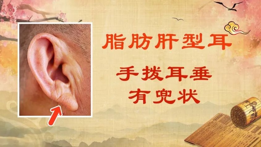 耳朵长这样，可能更长寿，耳上3处经常按，帮你通肠道、调血压、控血糖