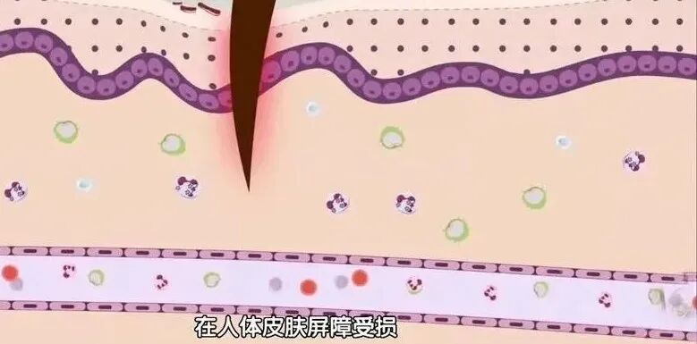 测出细菌、真菌几十万！夏天很多人天天在用这个物品