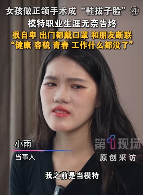 医院通报“24岁女孩正颌手术被做反”：当事医生已停诊，已成立专项调查组
