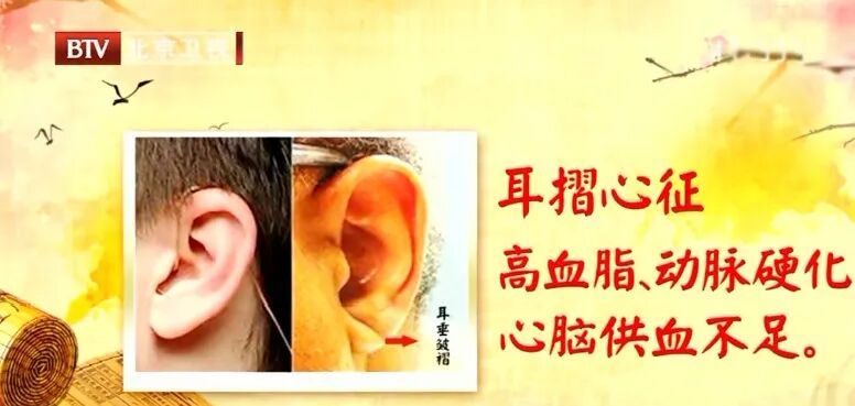 耳朵长这样，可能更长寿，耳上3处经常按，帮你通肠道、调血压、控血糖