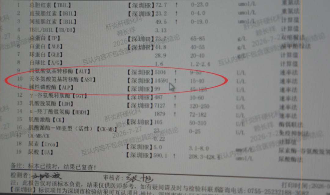 “小便颜色近乎棕色”！男子饮酒24小时后吃感冒药，肝脏指标直接飙升300多倍...