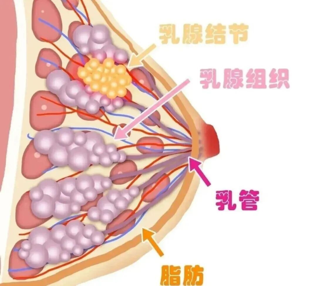 乳腺癌和胸部大小相关?“危险信号”看这里... 乳腺癌和胸部大小相关?“危险信号”看这里...