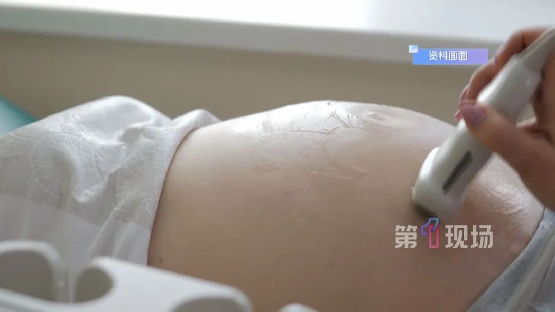 怀孕22周，女子突然尿不出来…一颗遗忘9年的结石，差点要了她和孩子的命！