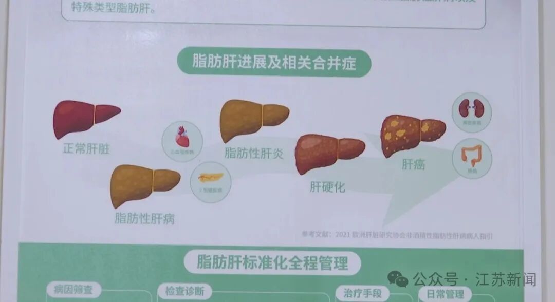 10岁男孩近200斤，确诊脂肪性肝炎！医生：要想逆转，体重至少要减50斤
