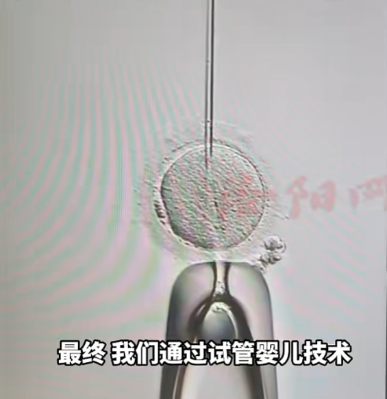 女子婚后多年未孕就医,发现自己竟有男性染色体和女性生殖系统 女子婚后多年未孕就医,发现自己竟有男性染色体和女性生殖系统