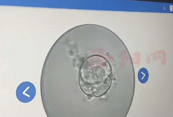 女子婚后多年未孕就医,发现自己竟有男性染色体和女性生殖系统 女子婚后多年未孕就医,发现自己竟有男性染色体和女性生殖系统