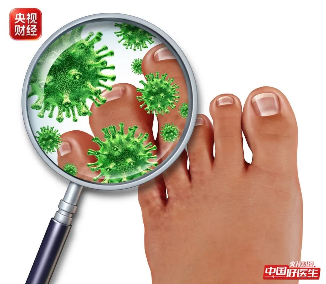 雨天蹚水“烂脚丫”？中医教你两招，远离脚气！