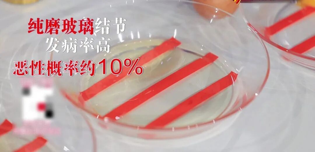很养肺的1个方法，让结节“绕道走”，每天6秒钟，痰清了、喘停了、气顺了